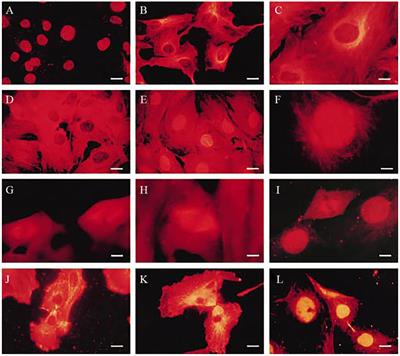 Nuclear βII-Tubulin and its Possible Utility in Cancer Diagnosis, Prognosis and Treatment